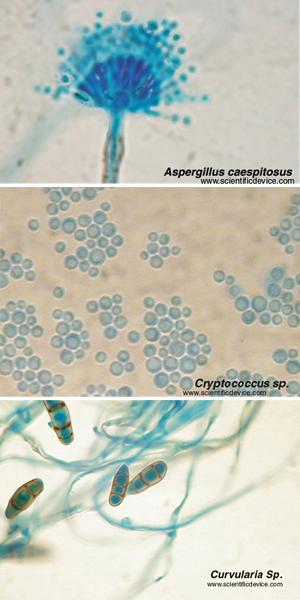 CLADOSPORIUM