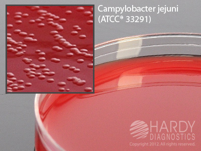 CAMPY CVA AGAR 15X100MM
