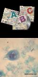 PARASITOLOGY SET A CD ROM